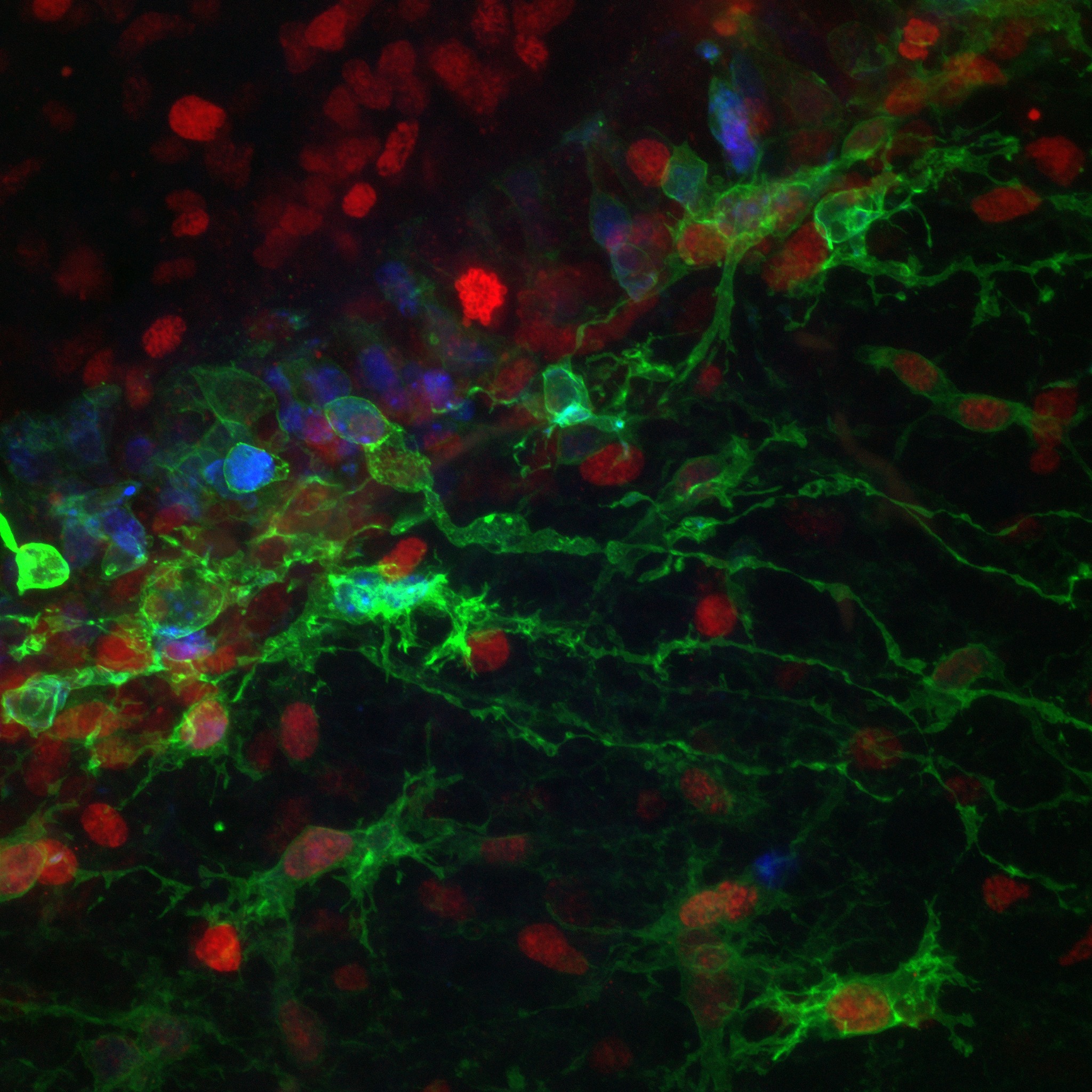 Fluorescence microscopy of HRas G12V-expressing neural cells