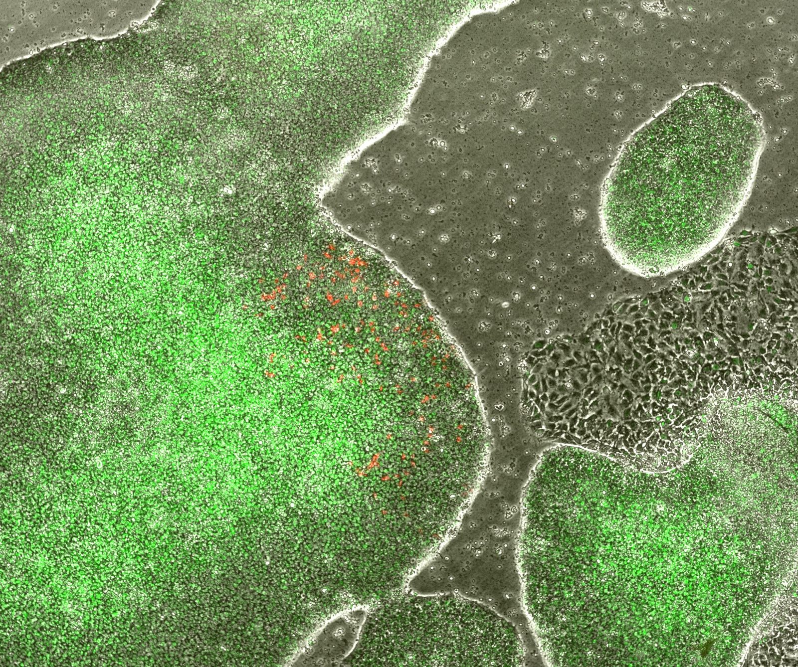 Fluorescence and brightfield image of engineered iPSC colonies